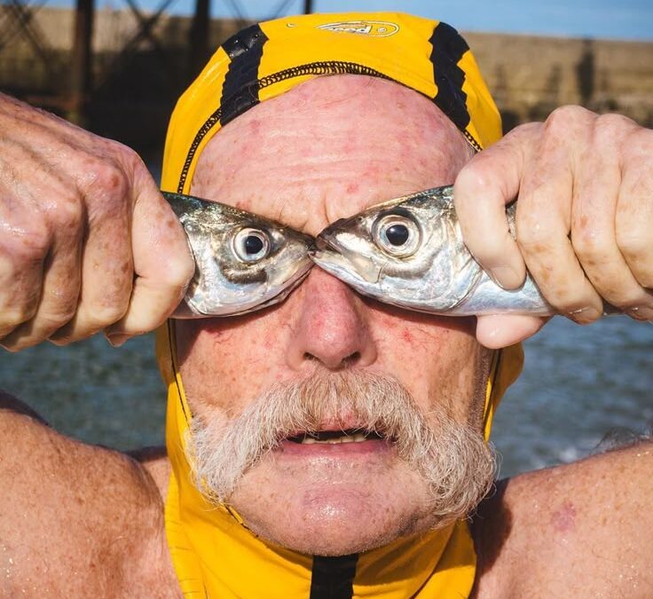 Iridocyclitis – When the eye is not just a local problem